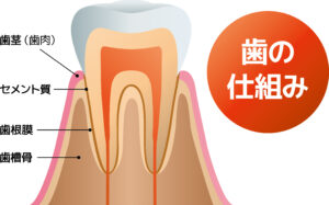 歯周病には４つの段階がある
