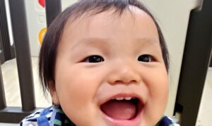 検診で上唇小帯（じょうしんしょうたい）と指摘されたけど大丈夫？